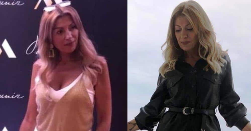 Το-σπάνιο-σύμπτωμα-που-εμφάνισε-η-κομμώτρια-στην-Πάτρα-μετά-τη-λιποαναρρόφηση-–-Τι-είπε-η-κόρη-της-για-τον-θάνατό-της